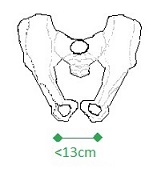 rozstaw kości kulszowych large