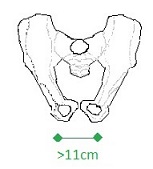 rozstawienie kości kulszowych small